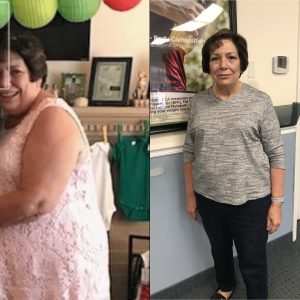 Before & After 1