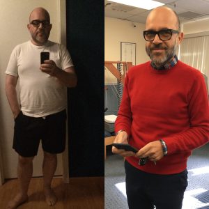 Before & After 2