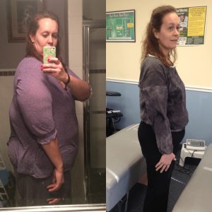 Before & After 4