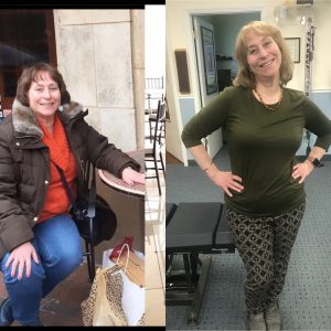 Before & After 5