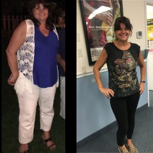 Before & After 6